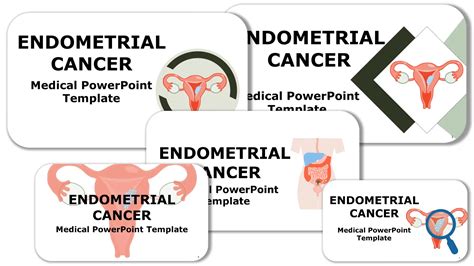 Download Endometrial Cancer Powerpoint Template Rxslides