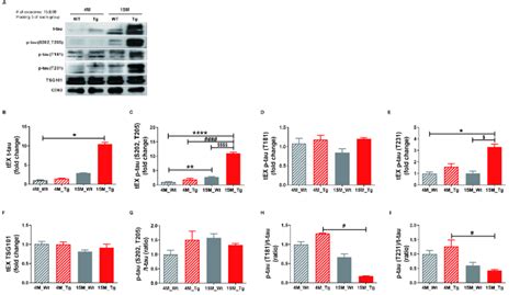 Total Tau And Phosphorylated Tau Expression Levels In Brain Tissue