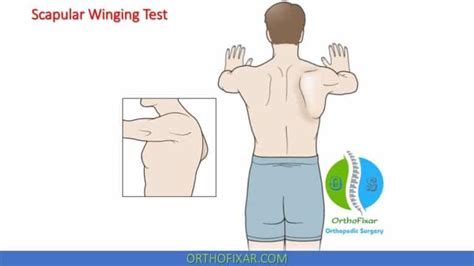 Scapular Winging Test Orthofixar