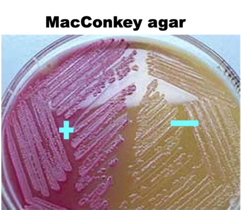 Bacteriology Exam Flashcards Quizlet