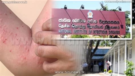 Second person infected with Monkeyfox admitted to IDH - Hiru News - Srilanka's Number One News ...