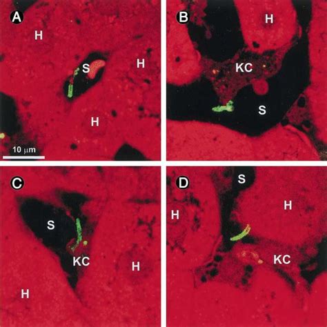 Plasmodium Sporozoites Attach To And Enter Kupffer Cells But Not