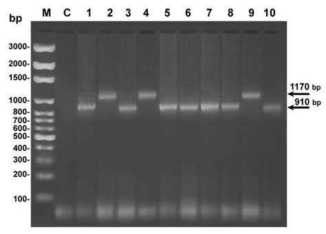 Agarose Gel Electrophoresis Showing Amplification Of 18s Rdna Of