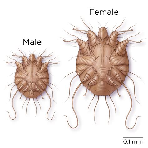 Question 6 Ectoparasitic Infections Question Bank National Std Curriculum