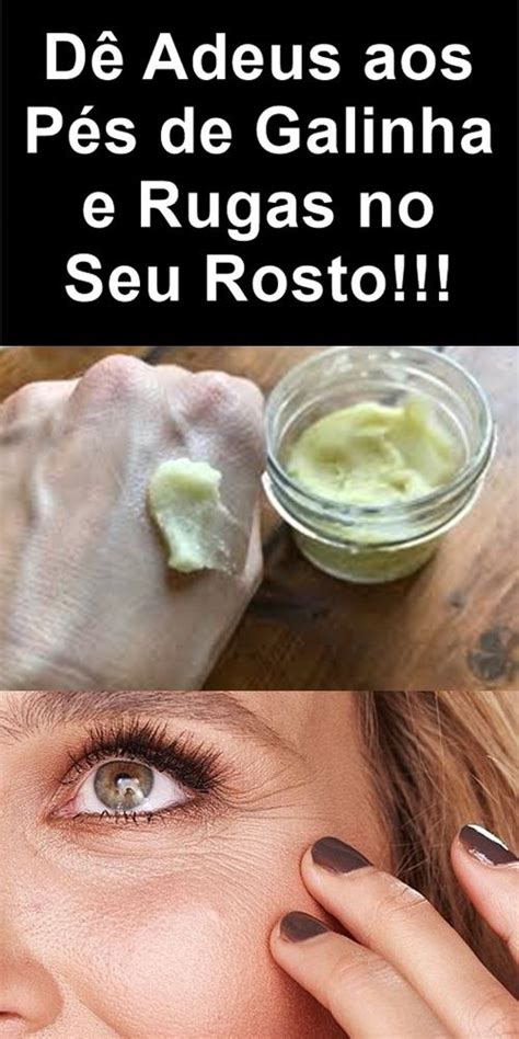 Como Eu Acabei Os P S De Galinha E Rugas Na Pele Em Semana Sem