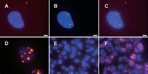 Frontiers Detection Of HPV And Human Chromosome Sites By Dual Color