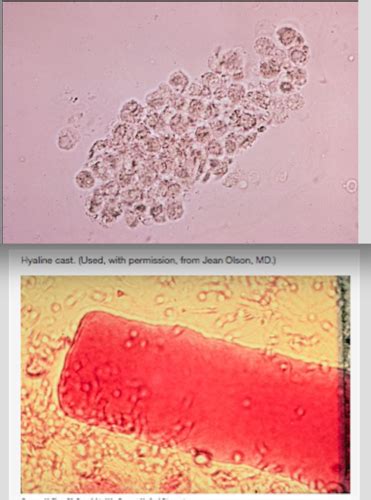 Urinalysis Reference Ranges Flashcards Quizlet