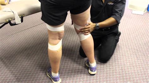 Knee Taping To Stop Over Extending My Physio Sa Adelaide