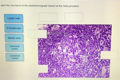 Solved Label The Structures In The Photomicrograph Based On Chegg