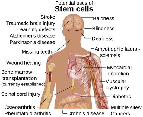 What is the Difference Between Embryonic and Somatic Stem Cells - Pediaa.Com