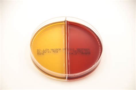 Bacteroides Bile Esculin And Laked Kanamycin Vancomycin Bi Plate BBE