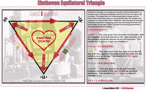 ecg educator mentor blog einthovens triangle