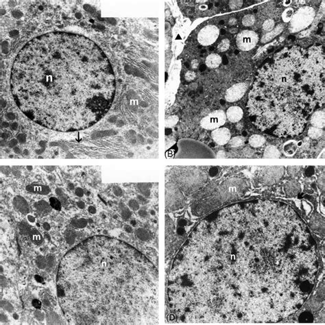 A Electron Micrograph Of Liver From A Control Rat Demonstrating Download Scientific Diagram