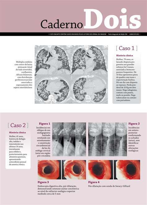 Pdf Caderno M Dico Radiologista Goi Nia Tumor Lobulado No Lobo