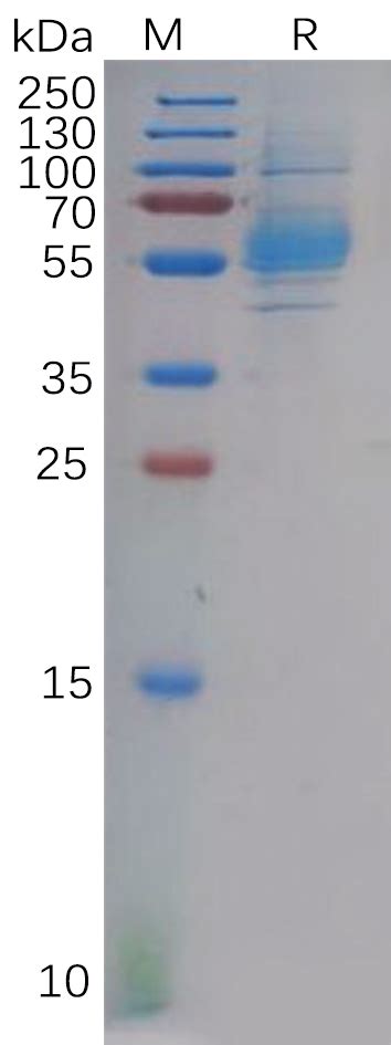 Human CLEC9A Protein hFc Tag 专注肿瘤免疫