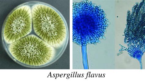 Aspergillus Morphology Clinical Features And Lab Diagnosis • Microbe