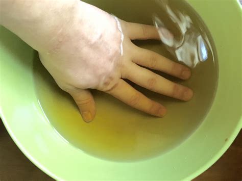 diy treatment for dry, cracked hands - What You Make It