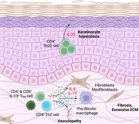 Skin T Cell Control Of Skin Structural Cells Benaroya Research Institute