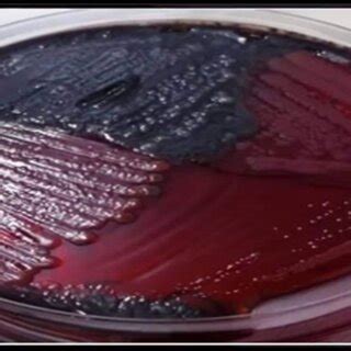 positive result of biofilm by Pseudomonas aeruginosa colonies on Congo ...