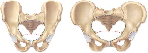 Male Vs Female Pelvis Diagram Quizlet