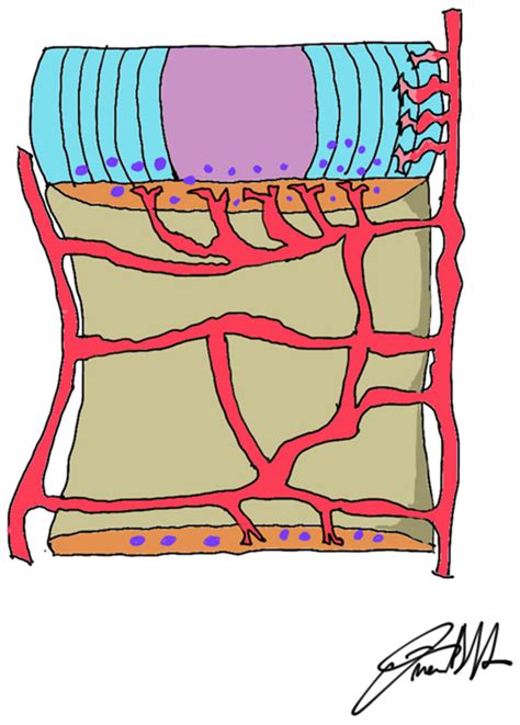 Jpm Free Full Text Degenerative Disc Disease Of The Spine From