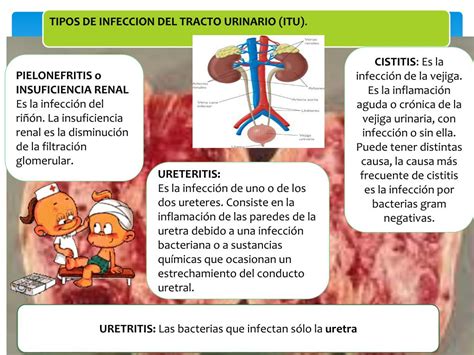 PPT Infección Tracto Urinario PowerPoint Presentation free download