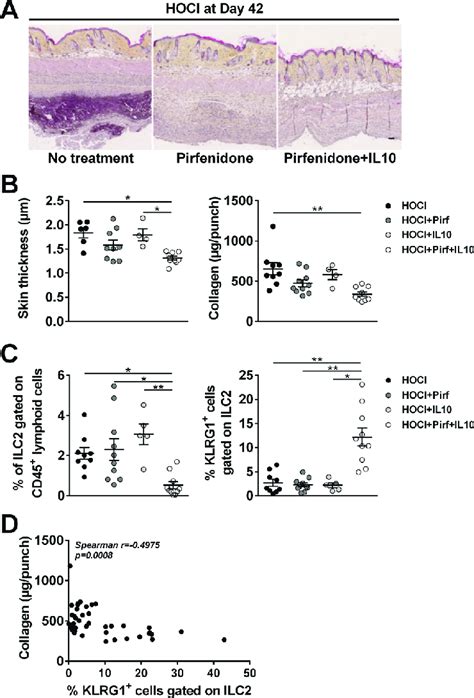 Interleukin IL 10 And Pirfenidone Pirf Reduce Fibrosis And Affect