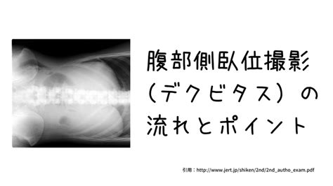 X線撮影｜腹部側臥位撮影（デクビタス）の流れとポイント｜放射線技師ヤマトのブログ