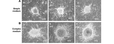 Cell Mounds In Confluent Human Wharton S Jelly Stem Cell Cultures