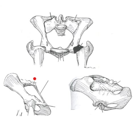 MSK Of Hindlimb Joints Flashcards Quizlet