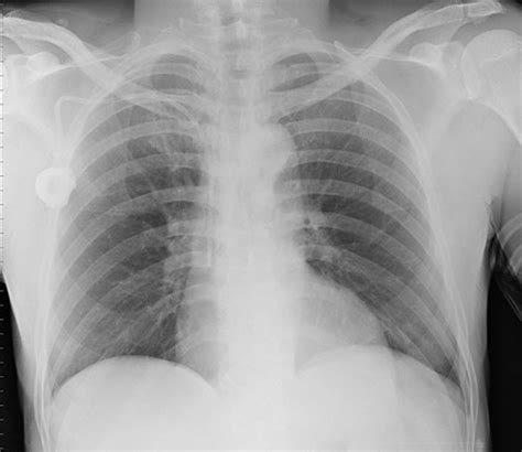 Comprehensive Radiography Test V Flashcards Quizlet