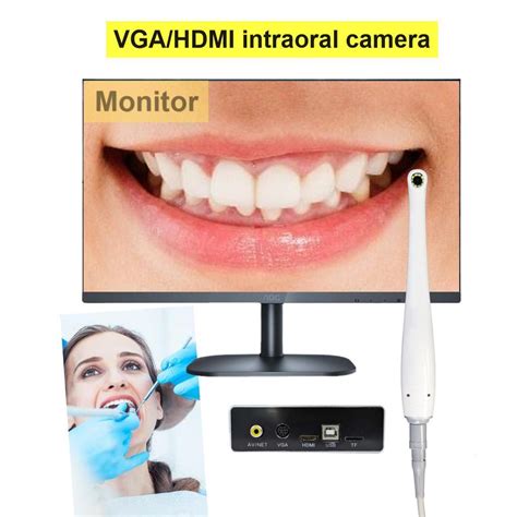 Medical Dental Camera 5V DC Power AV VGA Output To TV Screen China TV