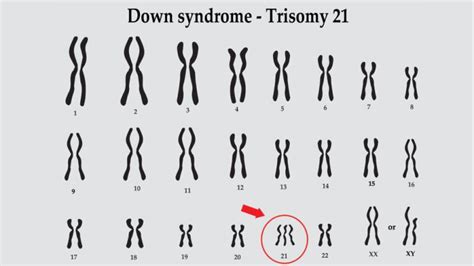 Karyotype: Definition, Purpose, Images