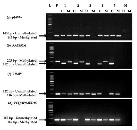 Agarose Gel Electrophoresis Of Methylation Specific Pcr Ms Pcr