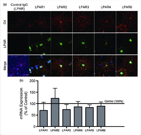 Expression Of Lpa Receptors Is Not Affected By Tat Treatment A