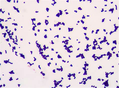 Chromosome Staining Techniques- Benefits and Limitations