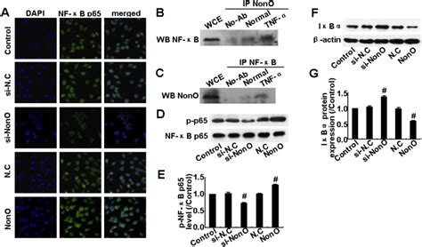 Silencing Of Non Pou Domain Containing Octamer Binding Protein