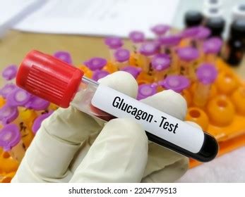 113 Glucagon Test Images, Stock Photos & Vectors | Shutterstock