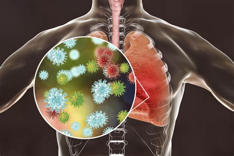 Ngs Respiratory Research Panel Inside Precision Medicine