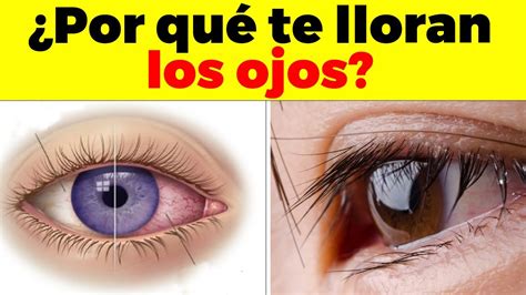 Porqué Me Lloran Los Ojos Causas Y Enfermedades Que Producen