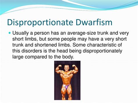 Ppt Dwarfism Powerpoint Presentation Free Download Id2211221