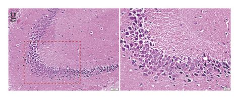 The H & E staining images of the CA1 region of hippocampus (left ... 