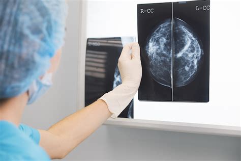 Women Perceive The Potential Benefits Of Mammograms To Be More