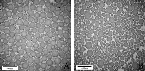 Tem Images Showing Two Typical Distributions Of The Collagen Fibril