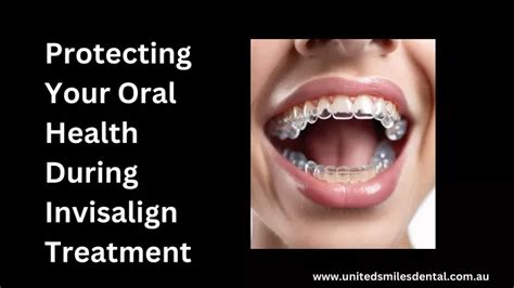 Ppt Protecting Your Oral Health During Invisalign Treatment Powerpoint Presentation Id 12663352