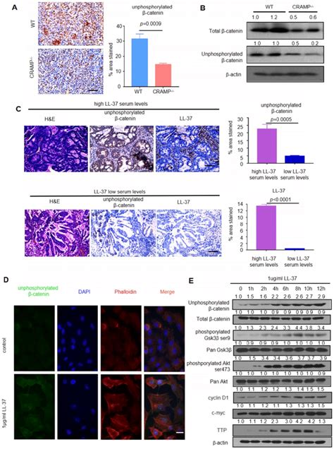 Ll 37 Activates Wnt β Catenin Signaling To Promote Growth Of Lung