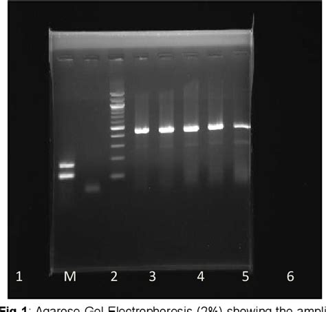 Figure 1 From Adaptation Of Classical Swine Fever Virus In Cell Culture System And Confirmation