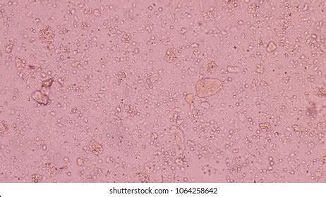 Budding Yeast Stool Exam Find Microscope Stock Photo 1064258642 | Shutterstock