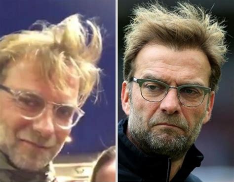 Jürgen Klopp Haartransplantation Ein genauerer Blick auf seine