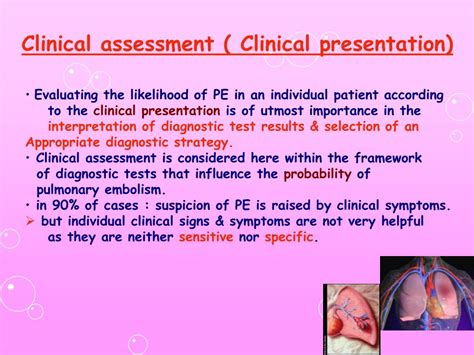 Ppt Diagnosis Of Pulmonary Embolism Powerpoint Presentation Free Download Id 3565428